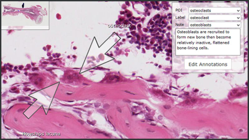 colourful image on a tablet computer of a microscope slide of cells in the femur of a rabbit with zoom and rotate tools visible on screen